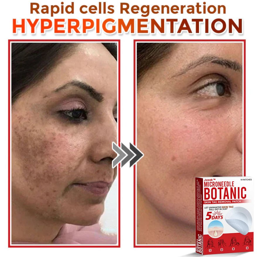 Juxek™ Removal Patch（1）