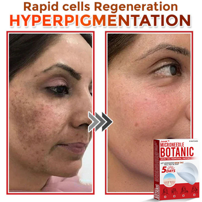 Juxek™ Removal Patch（1）