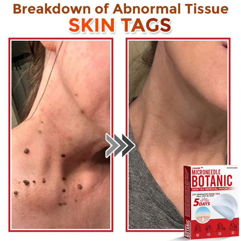 Juxek™ Removal Patch（1）