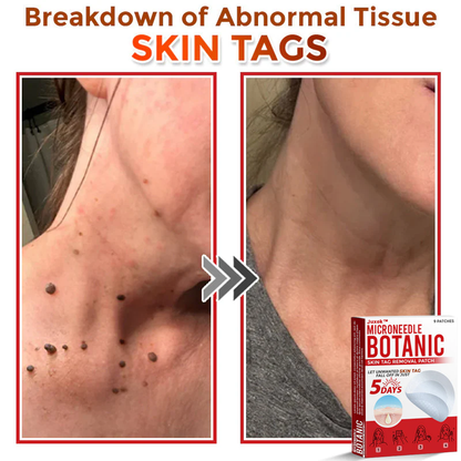 Juxek™ Removal Patch（1）